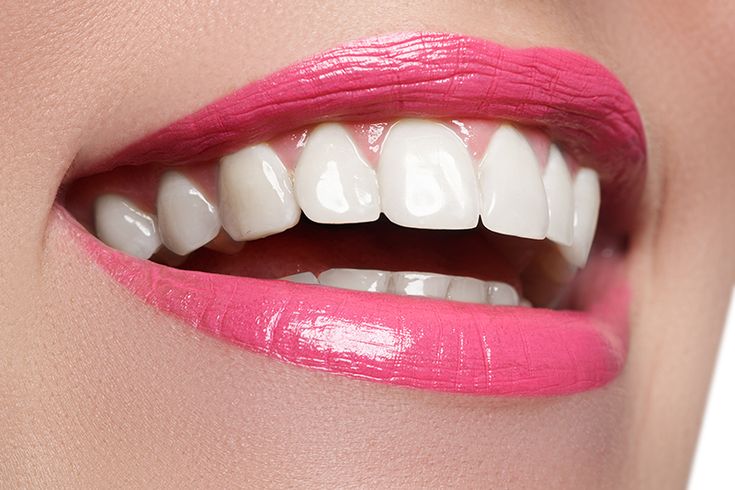 Porcelain Veneers Can Give You a Hollywood Smile Knollwood Dental Care Dentist Sterling Heights MI